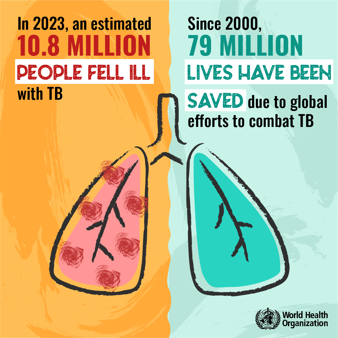 World TB Day 2025: A Global Call to Action and Pakistan’s Path Forward